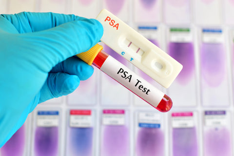 PSA Test Cassette (Whole Blood/Serum/Plasma)