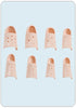 Mallet Finger Splint