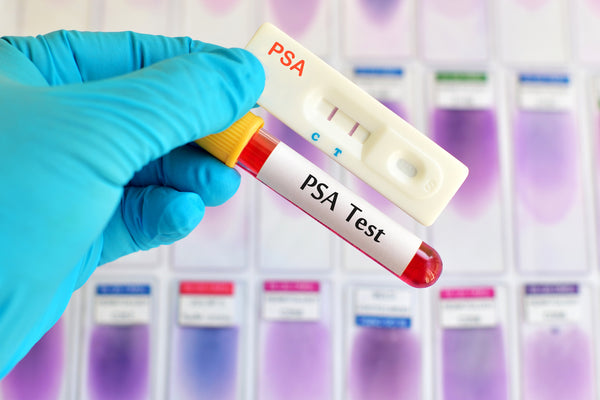 PSA Prostate Specific Antigen Rapid Test Casette